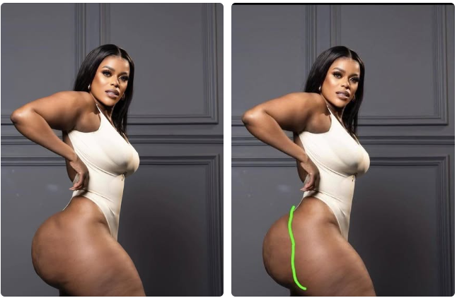 UNTOLD EFFECTS OF BBL: What Many Don’t Talk About